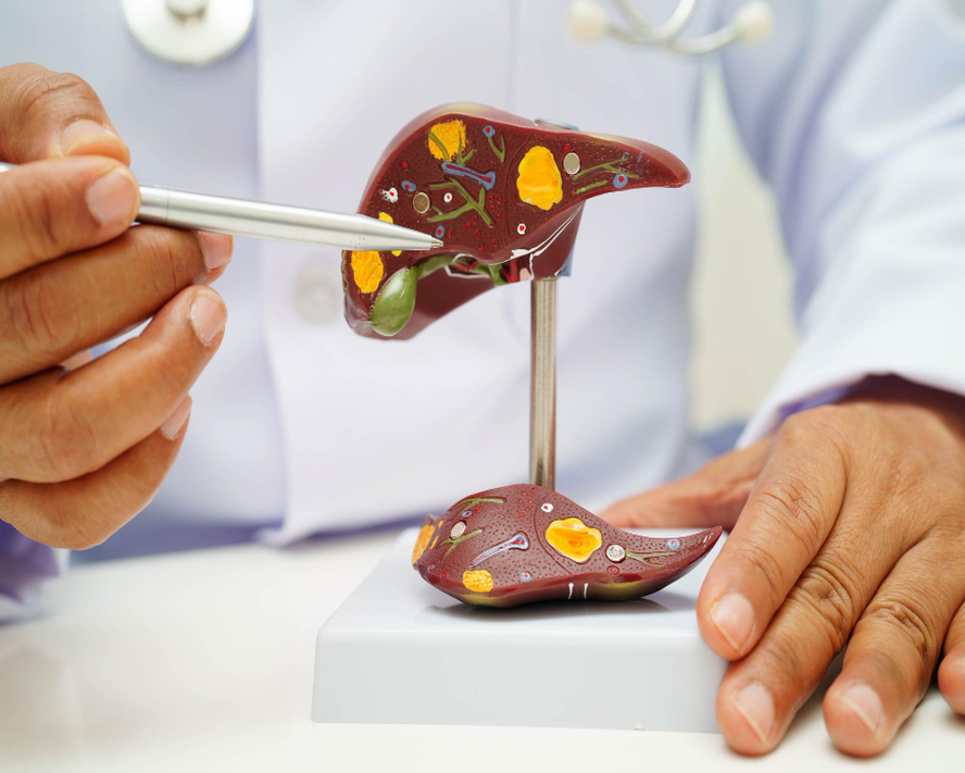 Karaciğer Büyümesi (Hepatomegali): Bilmeniz Gereken Her Şey