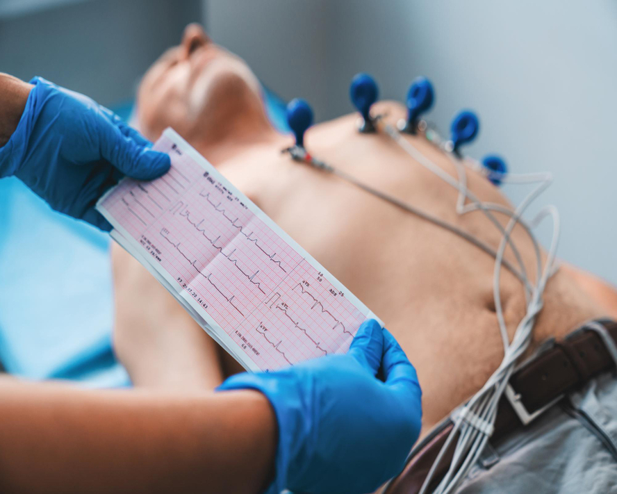 Holter Nedir? Kalp Sağlığınız İçin Önemi ve Kullanım Alanları