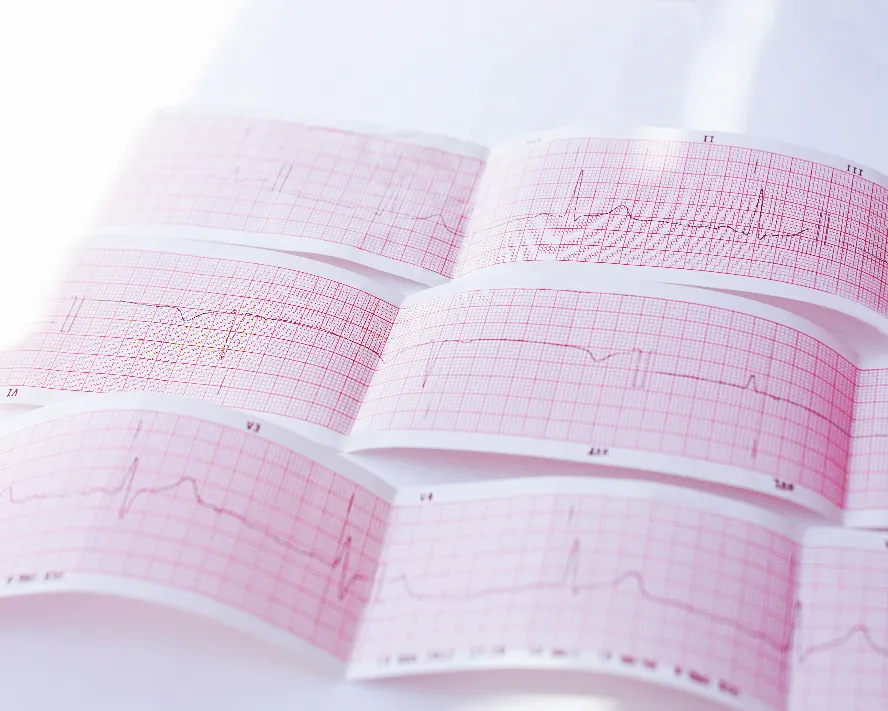 Mitral Kapak Prolapsusu Nedir?