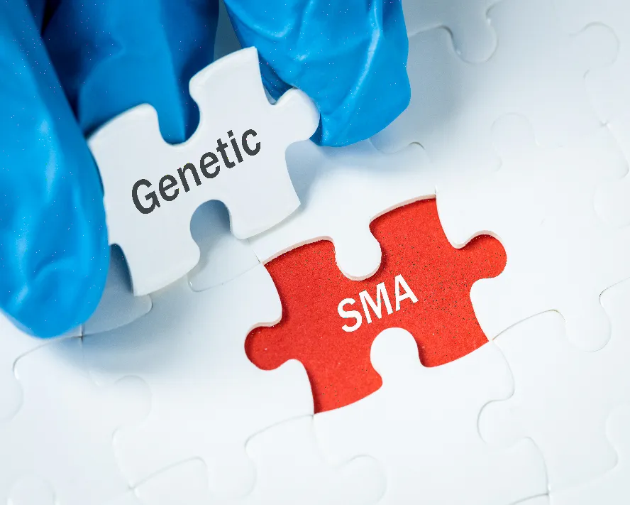 SMA Nedir? Belirtileri, Nedenleri ve Tedavisi
