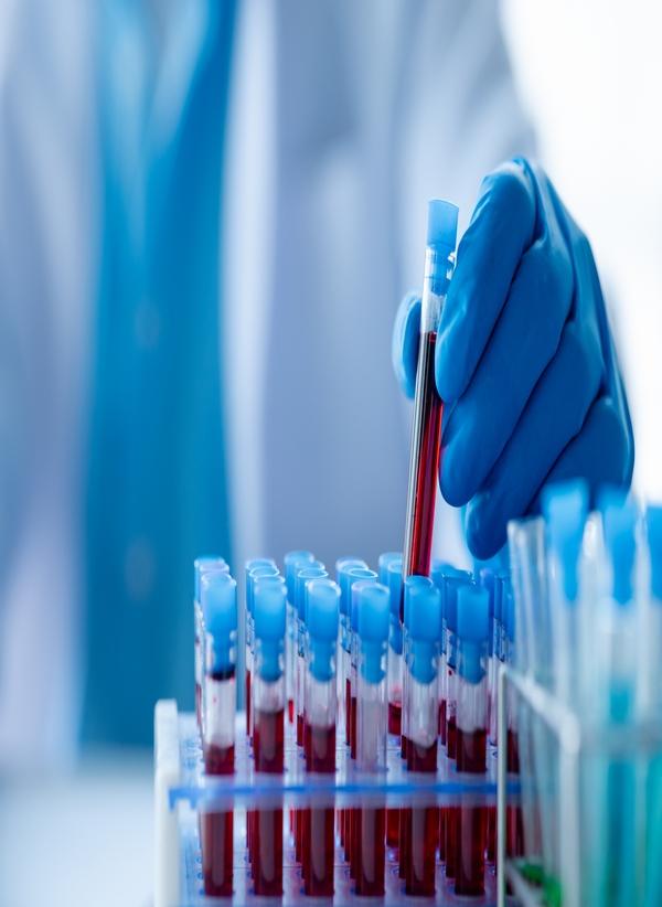 Karbonhidrat Metabolizması Paketi