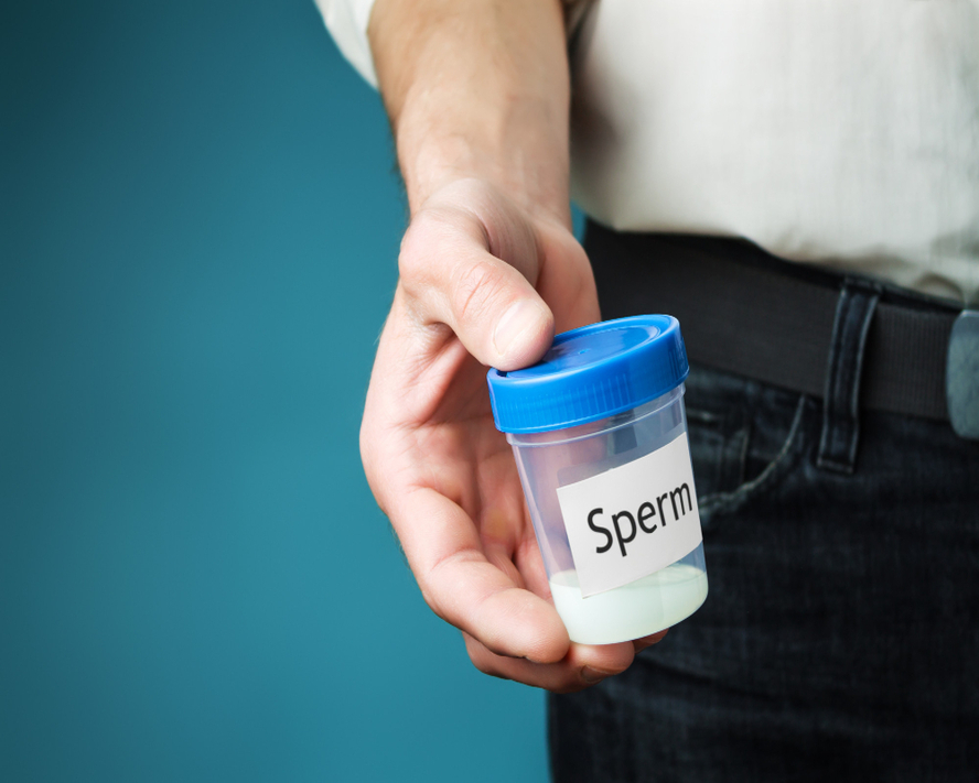Sperm Testi (Spermiogram): Bilmeniz Gereken Tüm Detaylar