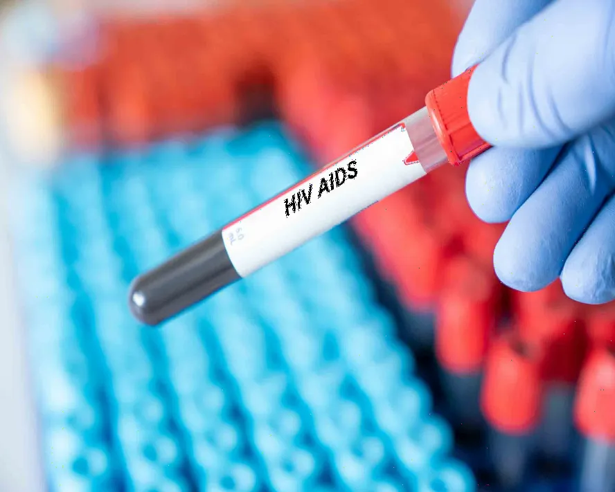 AİDS Belirtileri: HIV Enfeksiyonunun Evreleri ve Semptomları