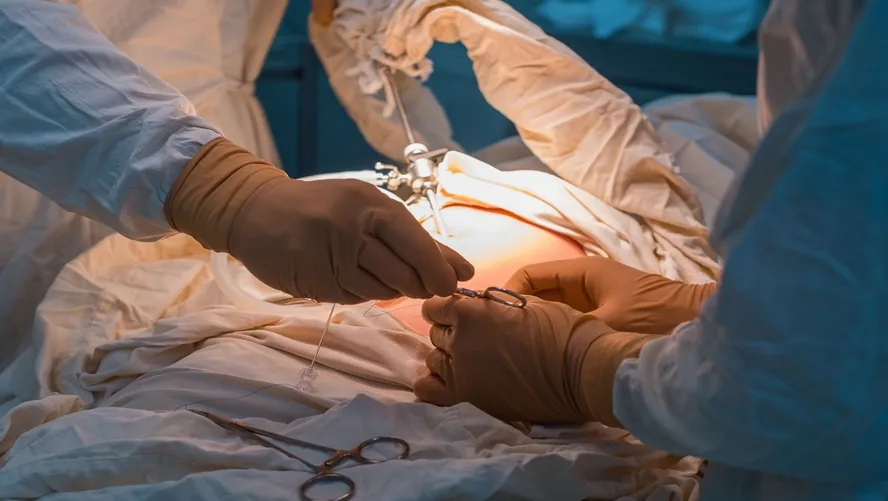 Gastrik Bypass Hakkında Tüm Merak Edilenler