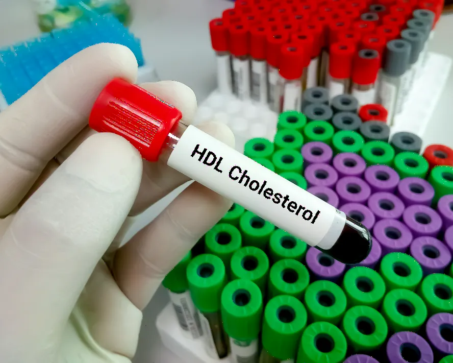 HDL Kolesterol Nedir? Sağlığınız İçin Önemi ve İpuçları