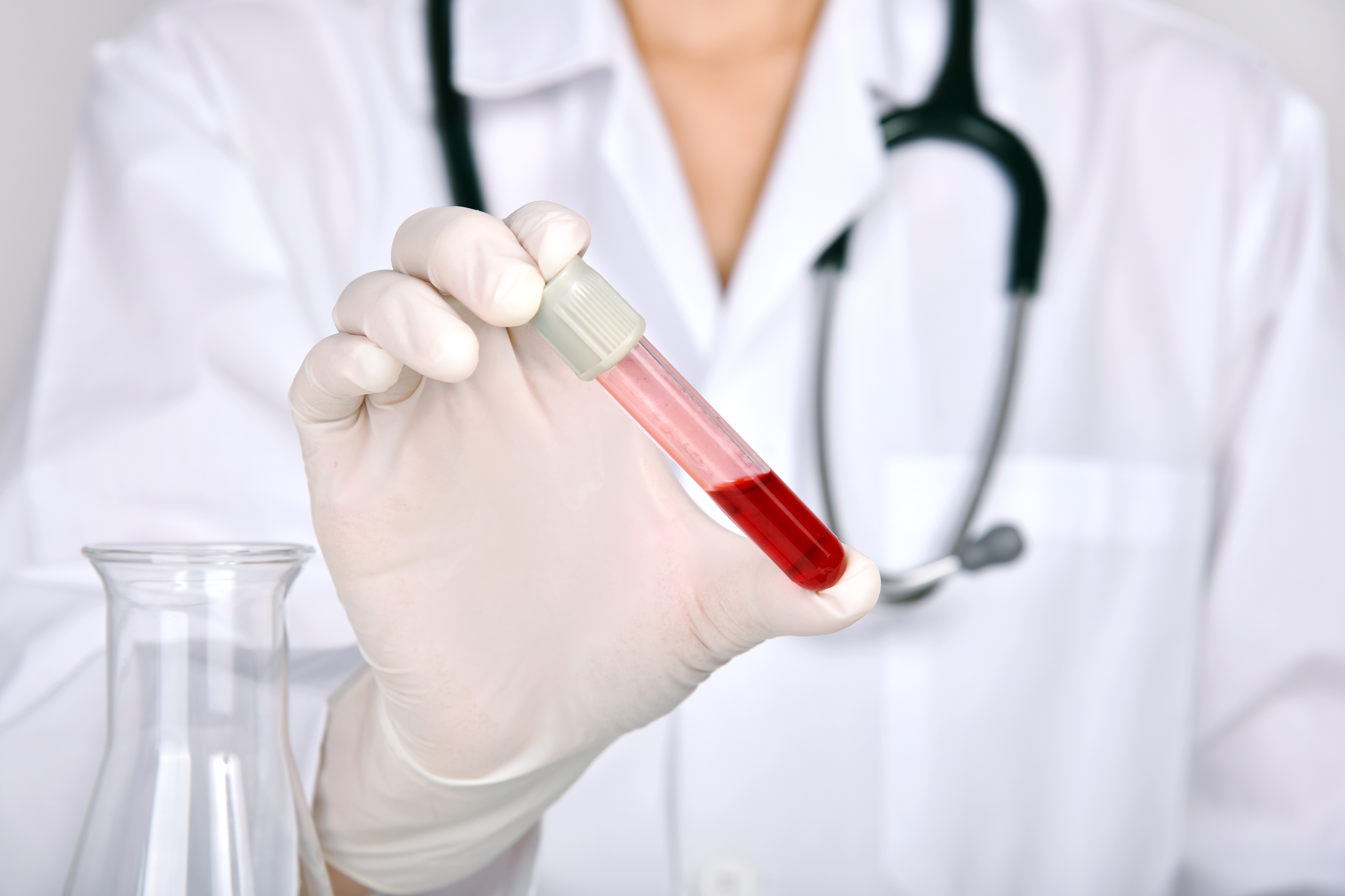 PDW Testi Nedir? PDW Düşüklüğü ve Yüksekliği