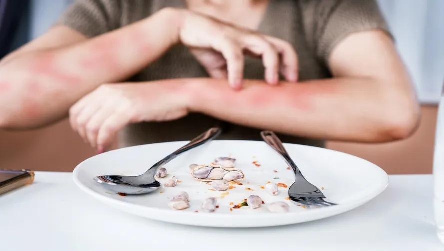 Anafilaksi Nedir? Anafilaksi Belirtileri
